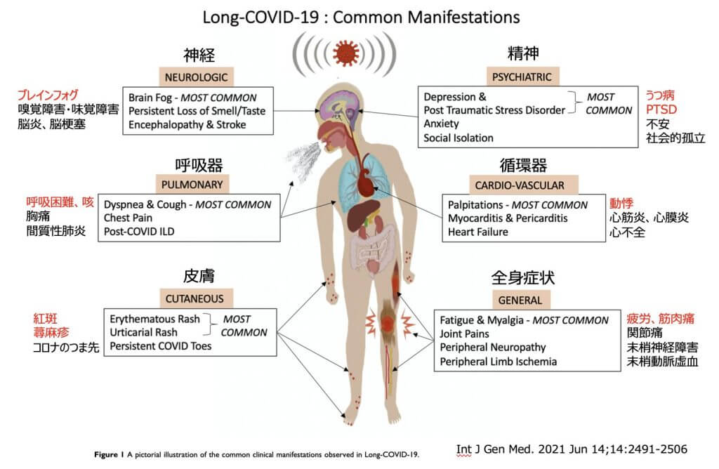 Stem Cell Exosome Nasal Administration as a Treatment Option for Post-COVID-19 Symptoms